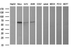 TH / Tyrosine Hydroxylase Antibody - Western blot of extracts (35ug) from 9 different cell lines by using anti-TH monoclonal antibody (HepG2: human; HeLa: human; SVT2: mouse; A549: human; COS7: monkey; Jurkat: human; MDCK: canine; PC12: rat; MCF7: human).