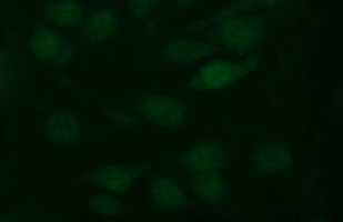 TH / Tyrosine Hydroxylase Antibody - Immunofluorescent staining of HeLa cells using anti-TH mouse monoclonal antibody.