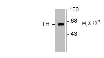 TH / Tyrosine Hydroxylase Antibody - Western blot of 10 ug of rat caudate lysate showing specific immunolabeling of the ~60k TH protein.