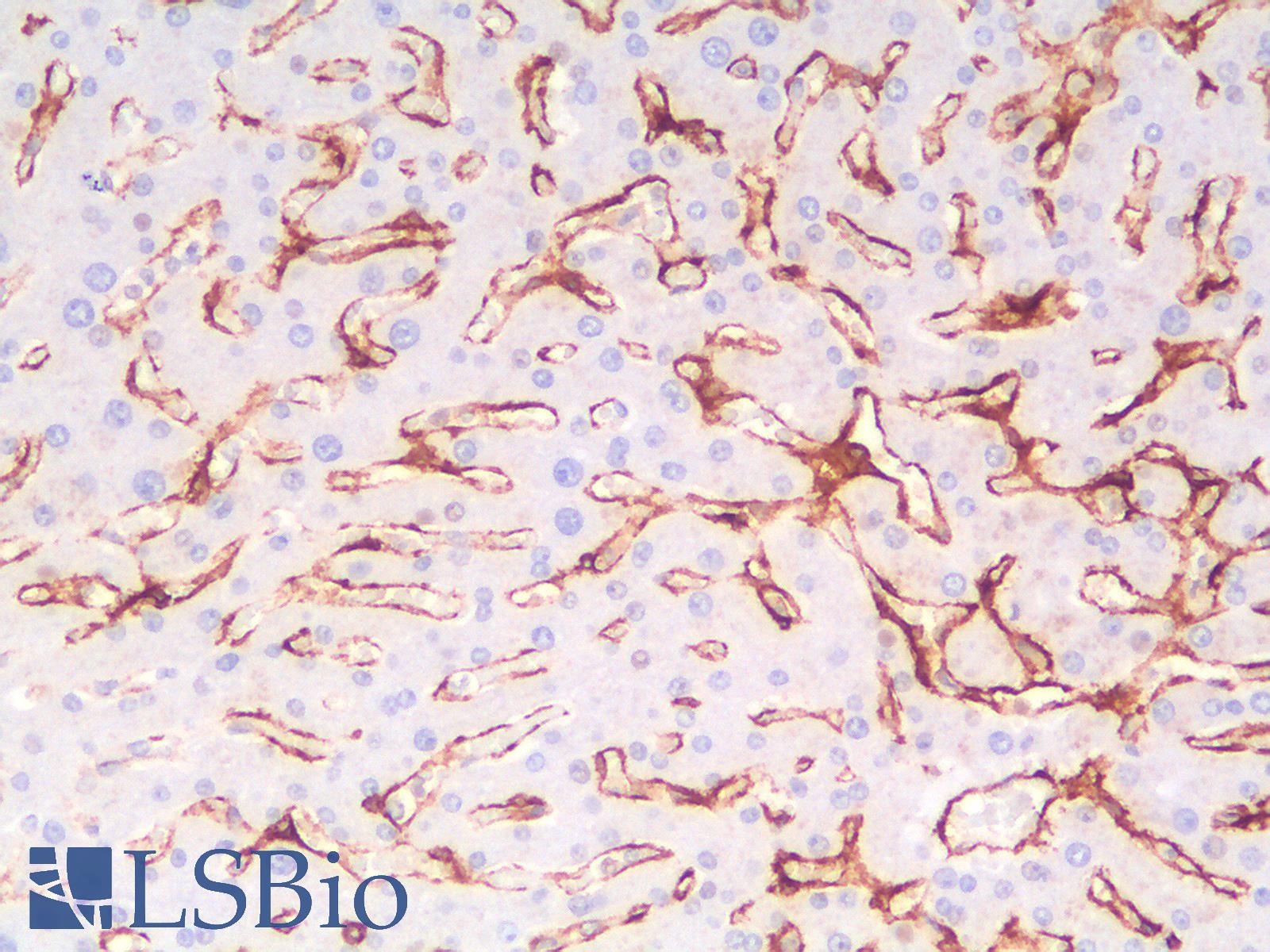 THBD / CD141 / Thrombomodulin Antibody - Human Liver: Formalin-Fixed, Paraffin-Embedded (FFPE)