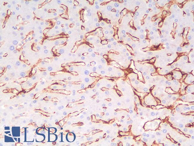 THBD / CD141 / Thrombomodulin Antibody - Human Liver: Formalin-Fixed, Paraffin-Embedded (FFPE)