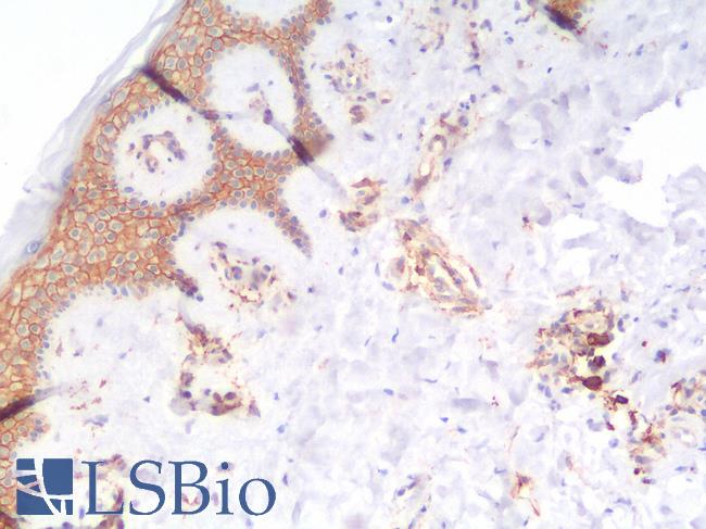 THBD / CD141 / Thrombomodulin Antibody - Human Skin: Formalin-Fixed, Paraffin-Embedded (FFPE)