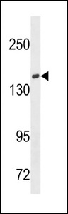 TIAM1 Antibody - TIAM1 Antibody western blot of ZR-75-1 cell line lysates (35 ug/lane). The TIAM1 antibody detected the TIAM1 protein (arrow).