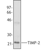TIMP2 Antibody - Western blot of recombinant human TIMP-2 protein using anti-TIMP-2, clone F27P3A4.