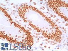 TLE1 / TLE 1 Antibody - Human Uterus: Formalin-Fixed, Paraffin-Embedded (FFPE)