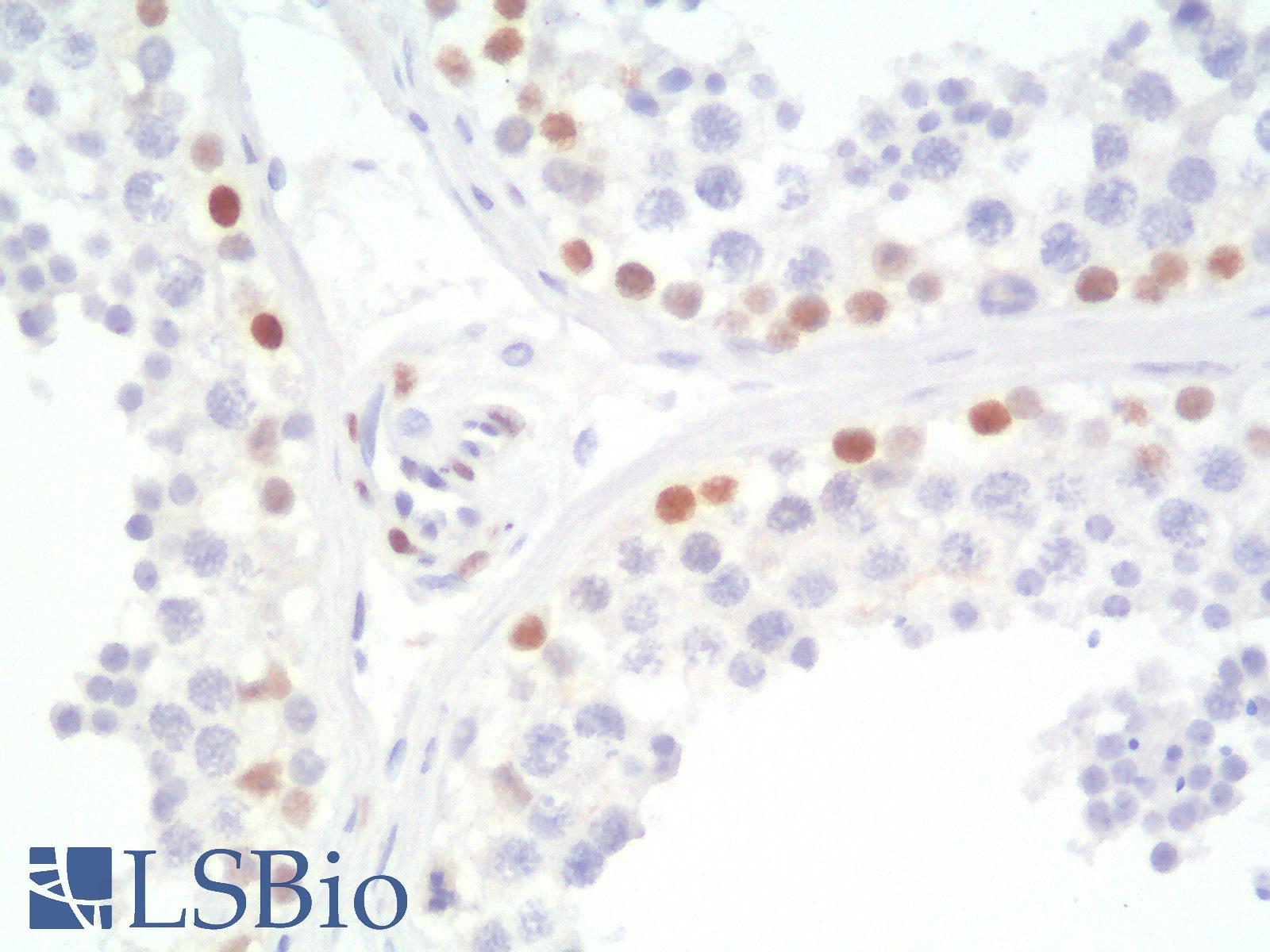 TLE1 / TLE 1 Antibody - Human Testis: Formalin-Fixed, Paraffin-Embedded (FFPE)