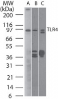 TLR4 Antibody - Western blot of TLR4 using antibody at 2 ug/ml on (A) human intestine and 6 ug/ml on (B) mouse intestine and C) rat intestine lysate.