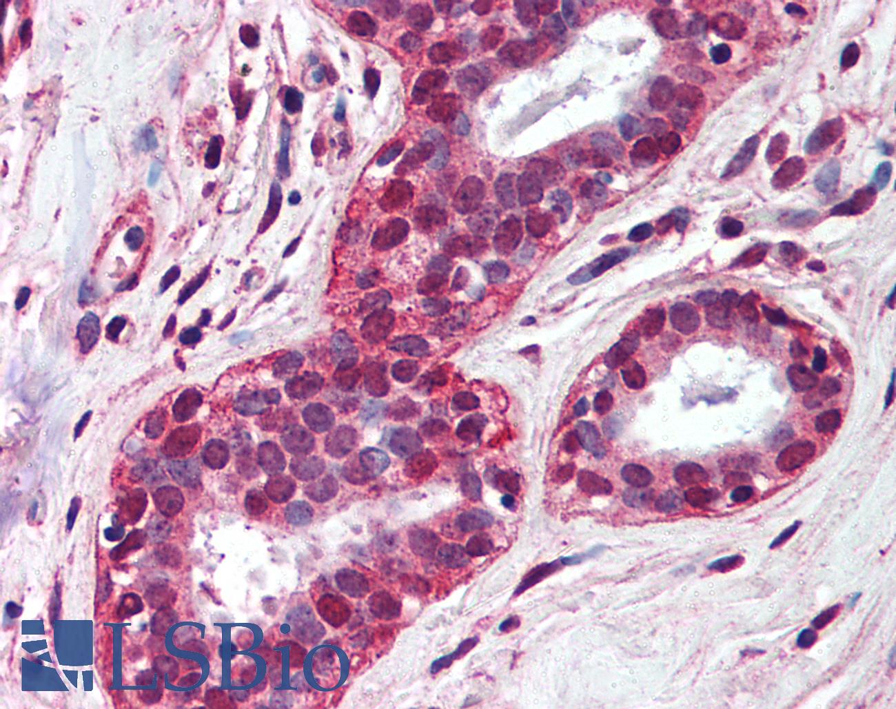 TLR4 Antibody - Anti-TLR4 antibody IHC of human breast. Immunohistochemistry of formalin-fixed, paraffin-embedded tissue after heat-induced antigen retrieval. Antibody concentration 5 ug/ml.