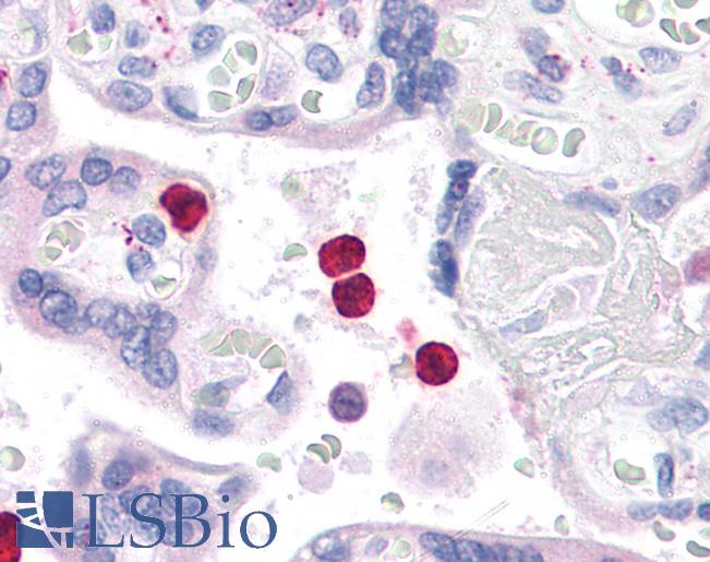 TLR4 Antibody - Anti-TLR4 antibody IHC of human neutrophils. Immunohistochemistry of formalin-fixed, paraffin-embedded tissue after heat-induced antigen retrieval. Antibody concentration 5 ug/ml.