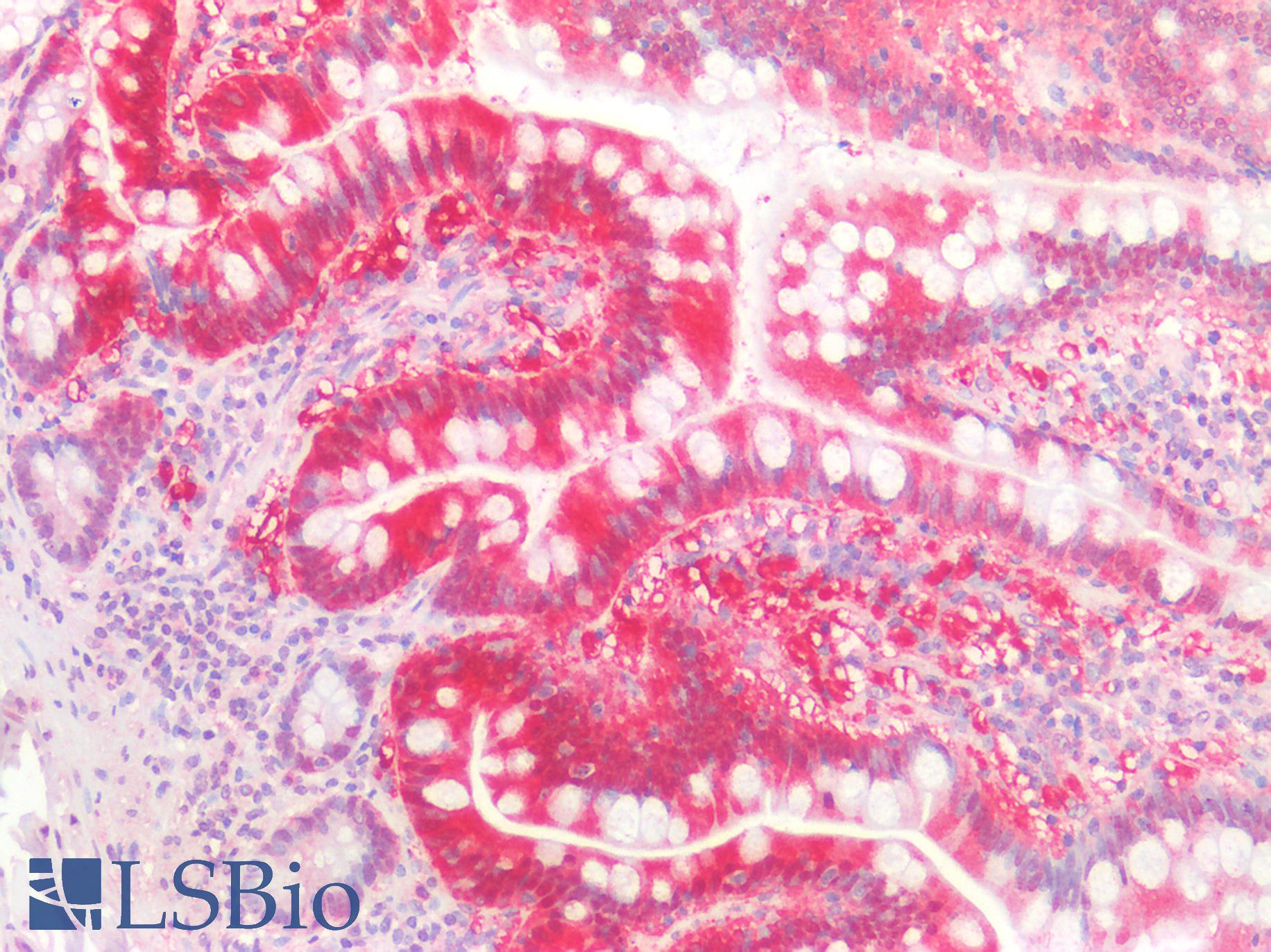 TMIGD2 Antibody - Human Small Intestine: Formalin-Fixed, Paraffin-Embedded (FFPE)