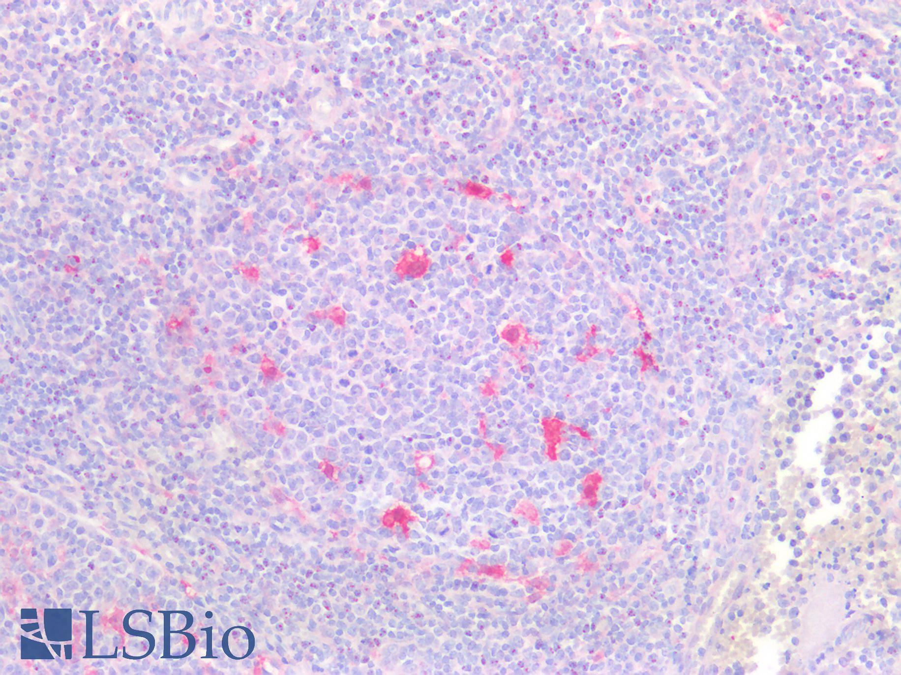 TMIGD2 Antibody - Human Tonsil: Formalin-Fixed, Paraffin-Embedded (FFPE)