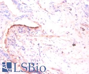 TNC / Tenascin C Antibody - Immunohistochemistry of paraffin-embedded human prostate using TNC / Tenascin C antibody at dilution of 1:50.  This image was taken for the unconjugated form of this product. Other forms have not been tested.