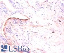 TNC / Tenascin C Antibody - Immunohistochemistry of paraffin-embedded human prostate using TNC / Tenascin C antibody at dilution of 1:50.  This image was taken for the unconjugated form of this product. Other forms have not been tested.