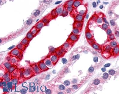 TNIK Antibody - Anti-TNIK antibody IHC of human kidney. Immunohistochemistry of formalin-fixed, paraffin-embedded tissue after heat-induced antigen retrieval.