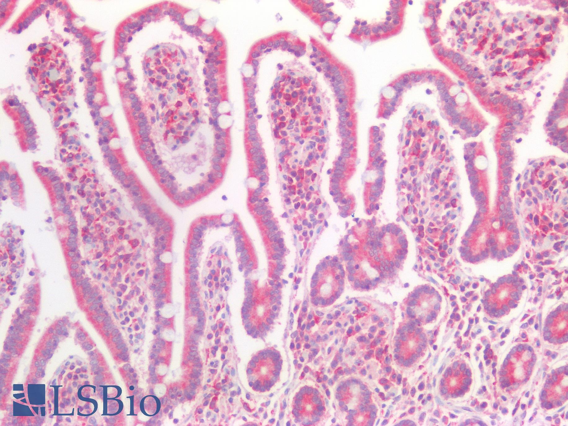 TNRC5 / CNPY3 Antibody - Human Small Intestine: Formalin-Fixed, Paraffin-Embedded (FFPE)