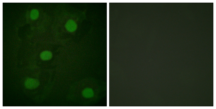 TP53 / p53 Antibody - Immunofluorescence analysis of HeLa cells, using p53 Antibody. The picture on the right is blocked with the synthesized peptide.