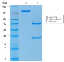 TP53 / p53 Antibody - SDS-PAGE Analysis Purified p53 Mouse Recombinant Monoclonal Antibody (rTP53/1739). Confirmation of Purity and Integrity of Antibody.