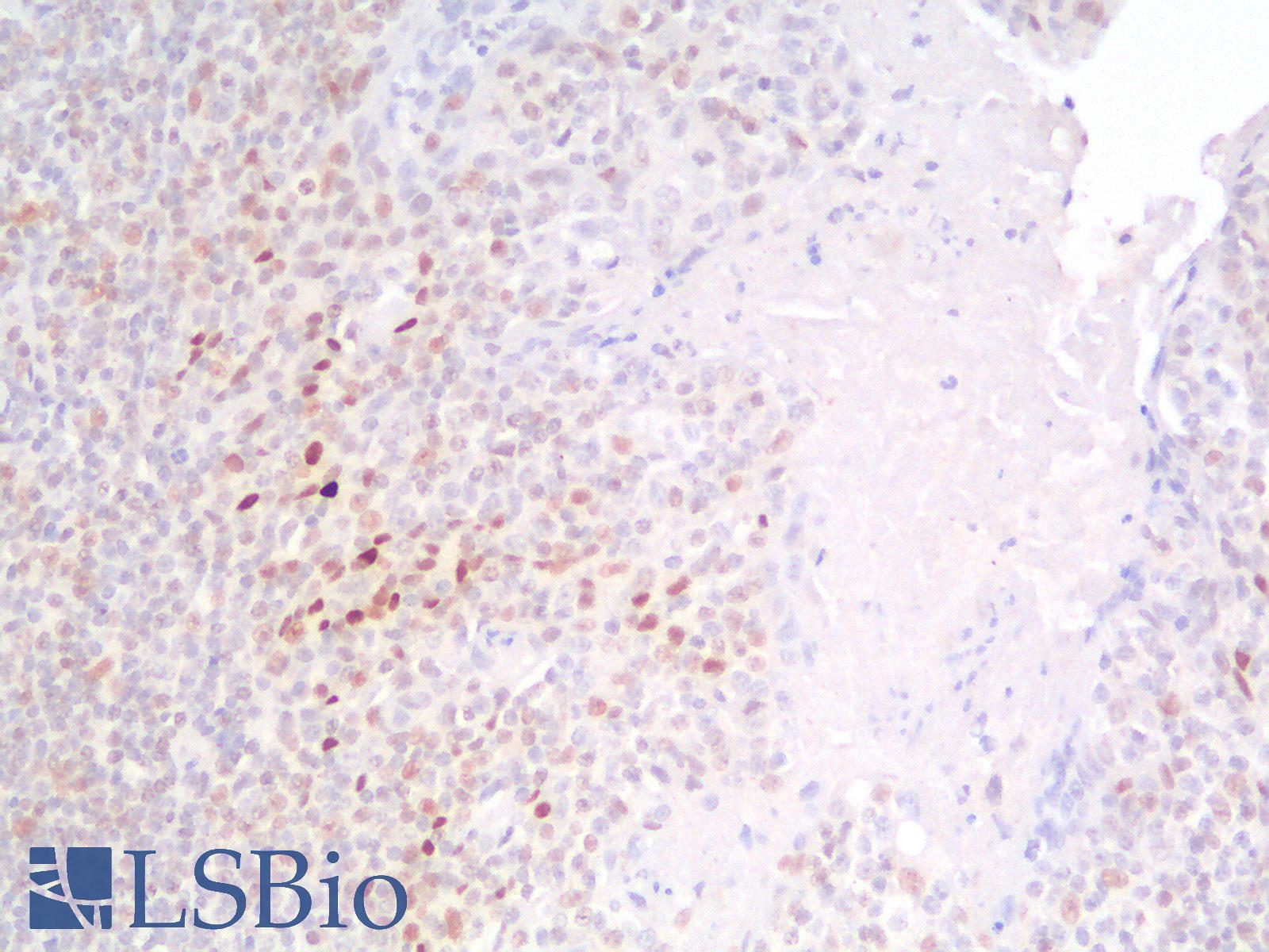 TP53 / p53 Antibody - Human Tonsil: Formalin-Fixed, Paraffin-Embedded (FFPE)
