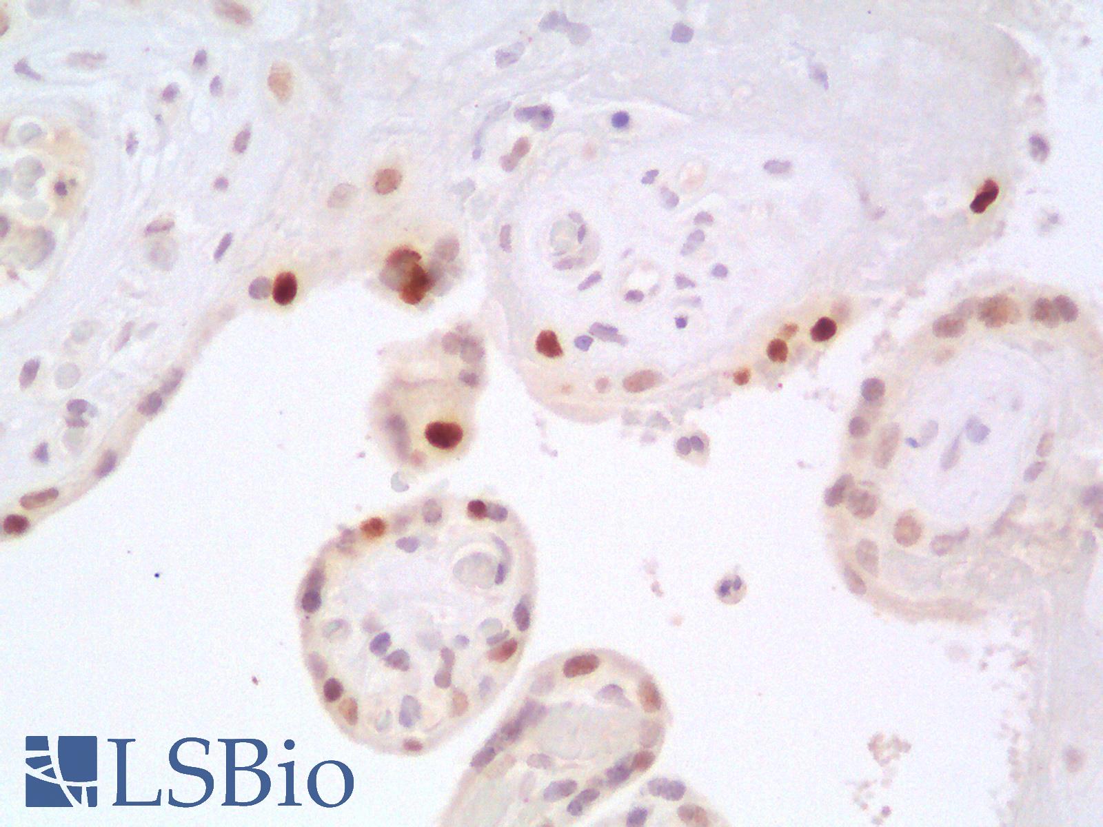 TP53 / p53 Antibody - Human Placenta: Formalin-Fixed, Paraffin-Embedded (FFPE)