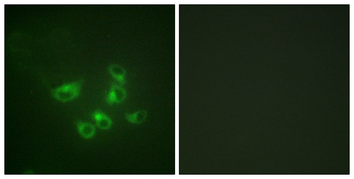TPH1 / Tryptophan Hydroxylase Antibody - Immunofluorescence analysis of HepG2 cells, using Tryptophan Hydroxylase Antibody. The picture on the right is blocked with the synthesized peptide.