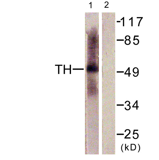 TPH1 / Tryptophan Hydroxylase Antibody - Western blot analysis of lysates from HepG2 cells, using Tryptophan Hydroxylase Antibody. The lane on the right is blocked with the synthesized peptide.