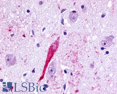 TPRA1 / GPR175 Antibody - Brain, Amygdala