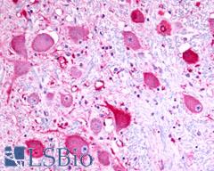 TPRA1 / GPR175 Antibody - Brain, Medulla