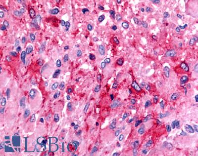 TPRA1 / GPR175 Antibody - Brain, glioblastoma