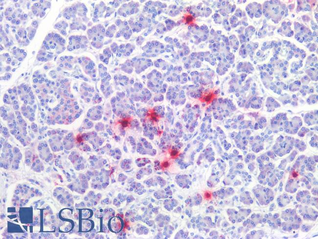 TPSAB1 / Mast Cell Tryptase Antibody - Human Pancreas, Mast Cells: Formalin-Fixed, Paraffin-Embedded (FFPE)