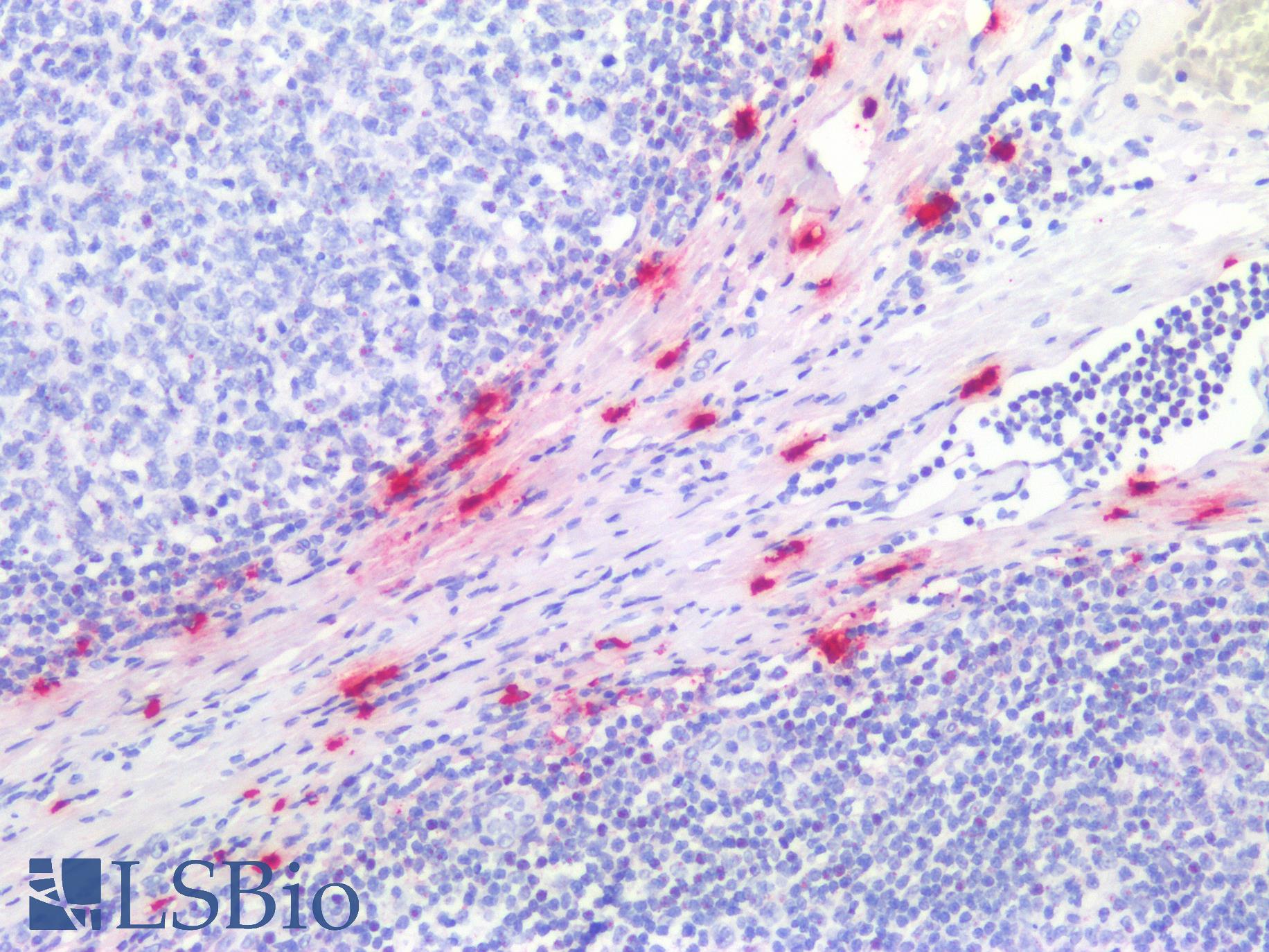 TPSAB1 / Mast Cell Tryptase Antibody - Human Tonsil, Mast Cells: Formalin-Fixed, Paraffin-Embedded (FFPE)