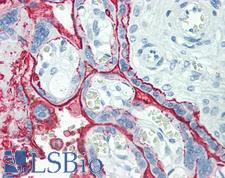 TPSAB1 / Mast Cell Tryptase Antibody - Human Placenta: Formalin-Fixed, Paraffin-Embedded (FFPE)