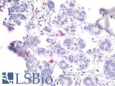 TPSAB1 / Mast Cell Tryptase Antibody - Human Breast, Mast Cells: Formalin-Fixed, Paraffin-Embedded (FFPE)