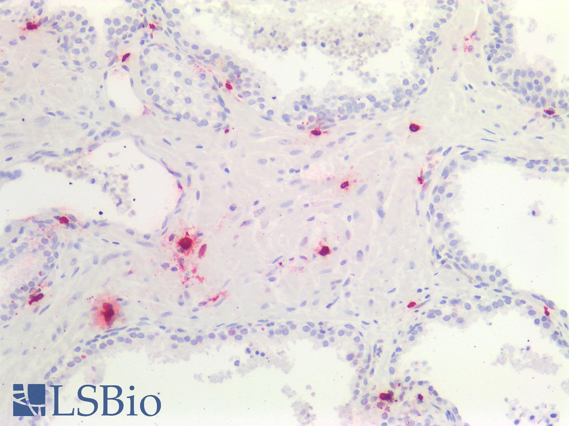 TPSAB1 / Mast Cell Tryptase Antibody - Human Prostate, Mast Cells: Formalin-Fixed, Paraffin-Embedded (FFPE)
