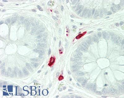 TPSAB1 / Mast Cell Tryptase Antibody - Human Colon, mast cells: Formalin-Fixed, Paraffin-Embedded (FFPE)