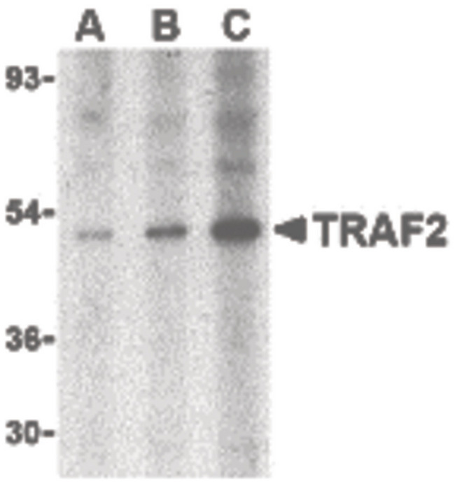 TRAF2 Antibody - Western blot of TRAF2 in human liver tissue lysate with TRAF2 antibody at (A) 0.5, (B) 1 and (C) 2 ug/ml.