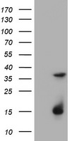 TS / Thymidylate Synthase Antibody - HEK293T cells were transfected with the pCMV6-ENTRY control (Left lane) or pCMV6-ENTRY TYMS (Right lane) cDNA for 48 hrs and lysed. Equivalent amounts of cell lysates (5 ug per lane) were separated by SDS-PAGE and immunoblotted with anti-TYMS.