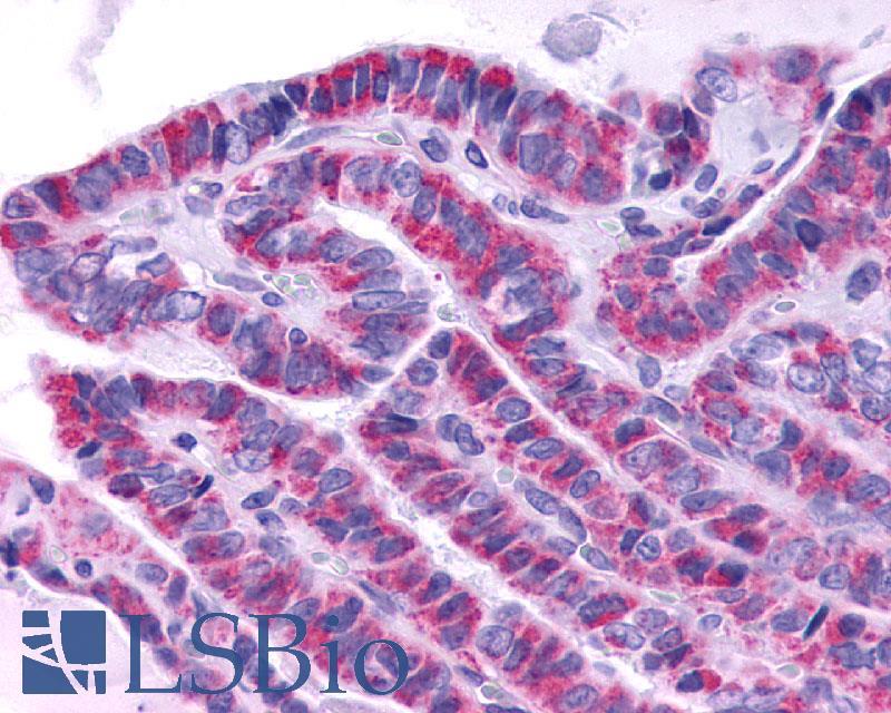 TSH Receptor / TSHR Antibody - Thyroid Papillary Carcinoma