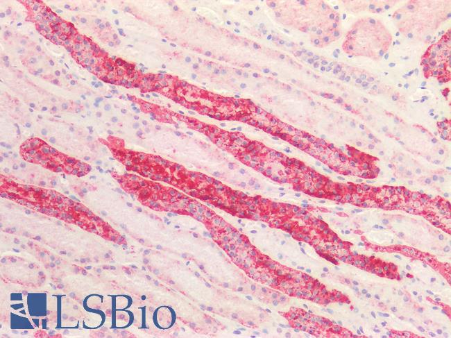 TTR / Transthyretin Antibody - Human Kidney: Formalin-Fixed, Paraffin-Embedded (FFPE)