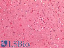 TTR / Transthyretin Antibody - Human Brain, Cortex: Formalin-Fixed, Paraffin-Embedded (FFPE)
