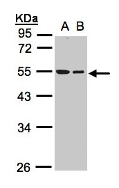 TUBB / Beta Tubulin Antibody - Sample (30 ug whole cell lysate). A: A431, B: Hep G2 . 10% SDS PAGE. TUBB / Beta Tubulin antibody diluted at 1:1000
