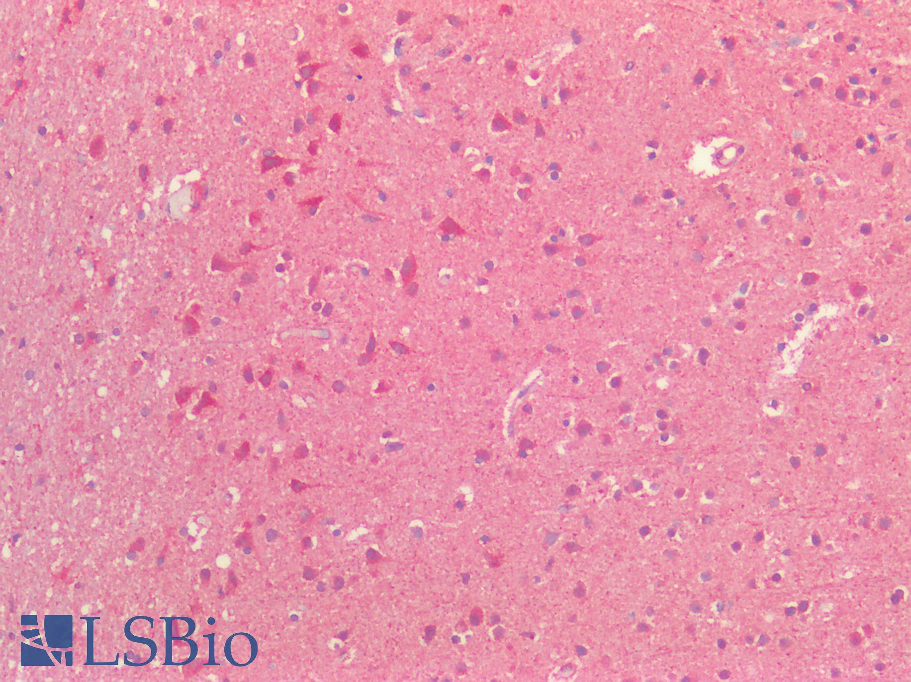 TUBB / Beta Tubulin Antibody - Human Brain, Cortex: Formalin-Fixed, Paraffin-Embedded (FFPE)