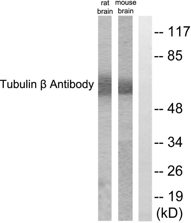 TUBB / Beta Tubulin Antibody - Western blot analysis of lysates from mouse brain and rat brain cells, using Tubulin beta Antibody. The lane on the right is blocked with the synthesized peptide.