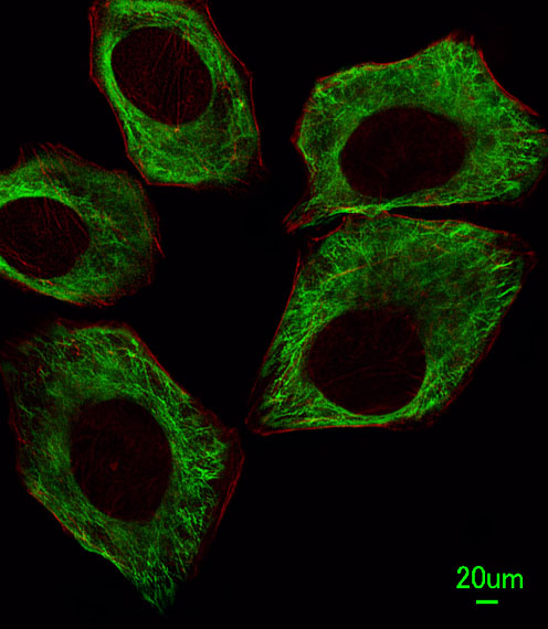 TUBB / Beta Tubulin Antibody - Immunofluorescence of A549 cells, using TBB5 Antibody. Antibody was diluted at 1:25 dilution. Dylight Fluor 488-conjugated goat anti-mouse lgG at 1:400 dilution was used as the secondary antibody (green). Cytoplasmic actin was counterstained with Dylight Fluor 554 (red) conjugated Phalloidin (red).