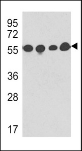 TUBB / Beta Tubulin Antibody - Western blot of anti-TBB5 Antibody in Y79,CEM,293 cell line and mouse brain tissue lysates (35 ug/lane). TBB5(arrow) was detected using the purified antibody.(1 ug/ml)
