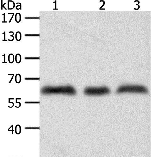 Tyrosinase Antibody - Western blot analysis of A375, HeLa and Jurkat cell, using TYR Polyclonal Antibody at dilution of 1:600.