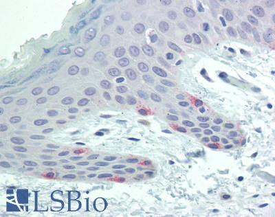 Tyrosinase Antibody - Human Skin, Melanocytes: Formalin-Fixed, Paraffin-Embedded (FFPE)