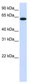 TYRP1 / gp75 Antibody - Western blot of 721_B Cell Lysate.  This image was taken for the unconjugated form of this product. Other forms have not been tested.