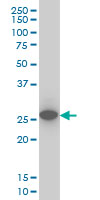 UCHL1 / PGP9.5 Antibody - Western blot of UCHL1 expression in IMR-32.