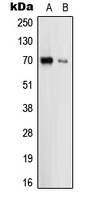 UMOD / Uromodulin Antibody - Western blot analysis of Uromodulin expression in HEK293T (A); THP1 (B) whole cell lysates.