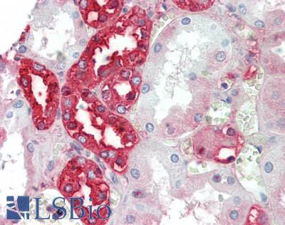 UMOD / Uromodulin Antibody - Human Kidney: Formalin-Fixed, Paraffin-Embedded (FFPE)